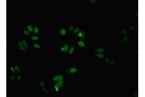 Immunofluorescent analysis of HepG2 cells using ABIN7145824 at dilution of 1:100 and Alexa Fluor 488-congugated AffiniPure Goat Anti-Rabbit IgG(H+L) (BRD9 Antikörper  (AA 338-597))