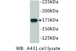 Image no. 1 for anti-Epidermal Growth Factor Receptor (EGFR) antibody (ABIN1112884) (EGFR Antikörper)