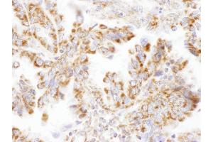 anti-Dihydrolipoamide S-Succinyltransferase (E2 Component of 2-Oxo-Glutarate Complex) (DLST) (AA 50-100) antibody
