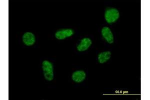 Immunofluorescence of purified MaxPab antibody to SART1 on HeLa cell.
