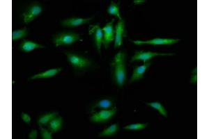 Immunofluorescence staining of Hela cells with ABIN7152365 at 1:200, counter-stained with DAPI. (EYA4 Antikörper  (AA 153-224))