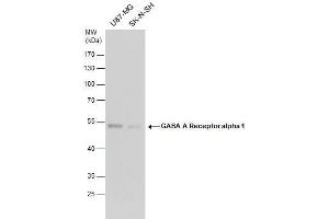 WB Image GABA A Receptor alpha 1 antibody detects GABA A Receptor alpha 1 protein by western blot analysis. (GABRA1 Antikörper  (Center))