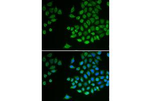 Immunofluorescence analysis of MCF-7 cell using PTPN2 antibody. (PTPN2 Antikörper)