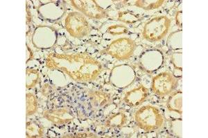 Immunohistochemistry of paraffin-embedded human kidney tissue using ABIN7142377 at dilution of 1:100 (MRPL21 Antikörper  (AA 40-205))