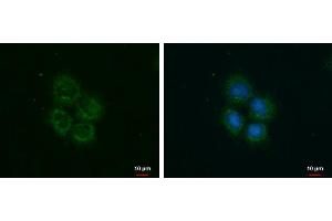 ICC/IF Image ROCK2 antibody detects ROCK2 protein at cytoplasm by immunofluorescent analysis. (ROCK2 Antikörper)