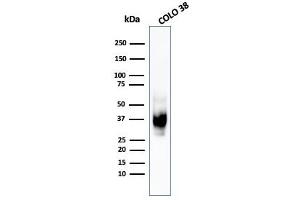 Western Blot Analysis of COLO-38 cell lysate using gp100 / Melanosome MAb (HMB45). (Melanoma gp100 Antikörper)