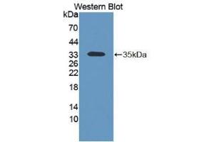 Western blot analysis of the recombinant protein. (KERA Antikörper  (AA 21-292))