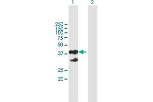 Western Blot analysis of EPCAM expression in transfected 293T cell line by EPCAM MaxPab polyclonal antibody. (EpCAM Antikörper  (AA 1-314))