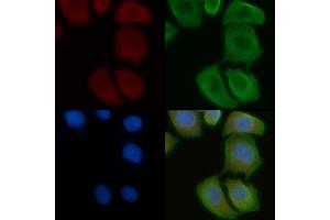 ABIN6258093 and ABIN6275148 staining Hela cells by IF/ICC.