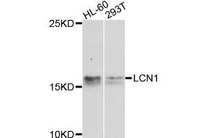 Western blot analysis of extracts of various cell lines, using LCN1 antibody (ABIN6003560) at 1/1000 dilution.