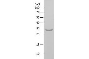 Western Blotting (WB) image for Potassium Voltage-Gated Channel, Shaker-Related Subfamily, beta Member 2 (KCNAB2) (AA 122-210) protein (His-IF2DI Tag) (ABIN7124534) (KCNAB2 Protein (AA 122-210) (His-IF2DI Tag))