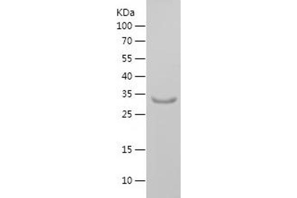 KCNAB2 Protein (AA 122-210) (His-IF2DI Tag)