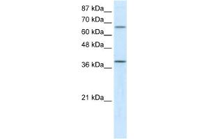 WB Suggested Anti-ACADM Antibody Titration:  5. (Medium-Chain Specific Acyl-CoA Dehydrogenase, Mitochondrial (N-Term) Antikörper)