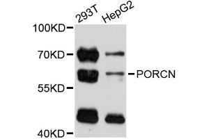 Western blot analysis of extracts of various cell lines, using PORCN antibody (ABIN5998572) at 1:3000 dilution. (PORCN Antikörper)