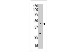 The APOBEC3G polyclonal antibody  is used in Western blot to detect APOBEC3G in A-549 cell lysate. (APOBEC3G Antikörper  (Internal Region))