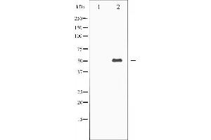 Western blot analysis of Keratin 8 expression in EGF treated 293 whole cell lysates,The lane on the left is treated with the antigen-specific peptide. (KRT8 Antikörper  (C-Term))