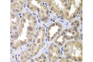 Immunohistochemistry of paraffin-embedded Human kidney using MAP2K4 Polyclonal Antibody at dilution of 1:100 (40x lens). (MAP2K4 Antikörper)