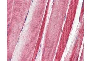 Immunohistochemical analysis of paraffin-embedded human skeletal musle tissues using DDR2 mouse mAb. (DDR2 Antikörper)