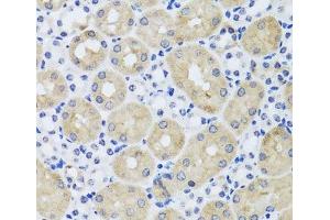 Immunohistochemistry of paraffin-embedded Mouse kidney using FGF13 Polyclonal Antibody at dilution of 1:100 (40x lens). (FGF13 Antikörper)