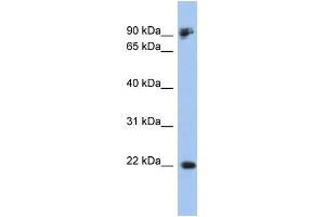 WB Suggested Anti-CDH1 Antibody Titration:  0. (E-cadherin Antikörper  (Middle Region))