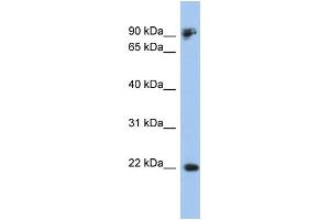 Western Blotting (WB) image for anti-Cadherin 1, Type 1, E-Cadherin (Epithelial) (CDH1) (Middle Region) antibody (ABIN2784498)