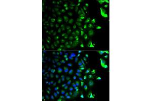 Immunofluorescence analysis of HeLa cell using RAB5A antibody. (RAB5 Antikörper  (AA 1-215))