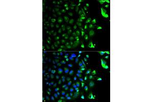 Immunofluorescence analysis of HeLa cell using RAB5A antibody. (RAB5 Antikörper  (AA 1-215))