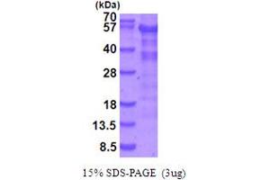 SDS-PAGE (SDS) image for serine/threonine Kinase 11 (STK11) (AA 1-433) protein (His tag) (ABIN5854061)