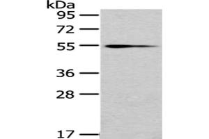 Gel: 8 % SDS-PAGE,Lysate: 40 μg,Primary antibody: ABIN7192987(UGT1A4 Antibody) at dilution 1/200 dilution,Secondary antibody: Goat anti rabbit IgG at 1/8000 dilution,Exposure time: 10 minutes