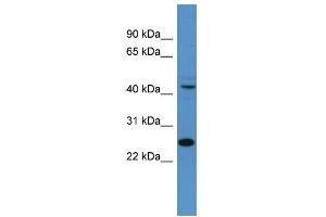 WB Suggested Anti-Tfdp1 Antibody Titration:  0.