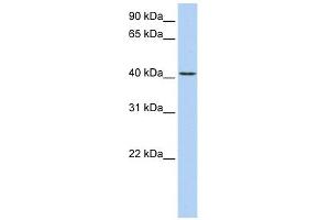 TMEM144 antibody used at 1 ug/ml to detect target protein. (TMEM144 Antikörper  (Middle Region))