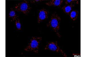 Proximity Ligation Analysis of protein-protein interactions between FLT1 and CRKL. (FLT1 Antikörper  (AA 1-687))