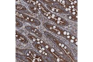 Immunohistochemical staining of human duodenum with UCN3 polyclonal antibody  shows strong granular cytoplasmic positivity in glandular cells at 1:200-1:500 dilution. (UCN3 Antikörper)