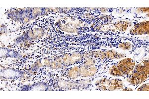 Detection of CXCR4 in Human Stomach Tissue using Polyclonal Antibody to Chemokine C-X-C-Motif Receptor 4 (CXCR4) (CXCR4 Antikörper  (AA 262-352))