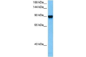 Host:  Mouse  Target Name:  GRM6  Sample Tissue:  Mouse Kidney  Antibody Dilution:  1ug/ml (Metabotropic Glutamate Receptor 6 Antikörper  (C-Term))