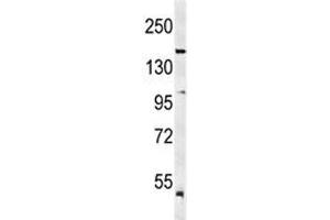Western blot analysis of KDR antibody and mouse lung tissue lysate. (VEGFR2/CD309 Antikörper  (AA 1153-1182))