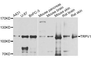 Western blot analysis of extracts of various cell lines, using TRPV1 antibody (ABIN5996282) at 1/1000 dilution. (TRPV1 Antikörper)