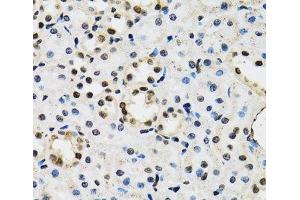 Immunohistochemistry of paraffin-embedded Mouse kidney using JADE1 Polyclonal Antibody at dilution of 1:100 (40x lens). (PHF17 Antikörper)