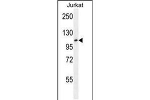 Western blot analysis in Jurkat cell line lysates (35ug/lane). (KDM2A Antikörper  (AA 500-527))