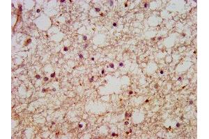 IHC image of ABIN7151025 diluted at 1:600 and staining in paraffin-embedded human brain tissue performed on a Leica BondTM system. (HACE1 Antikörper  (AA 333-442))