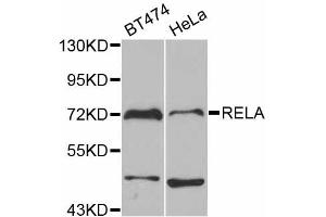 Western blot analysis of extracts of various cell lines, using RELA antibody. (NF-kB p65 Antikörper)