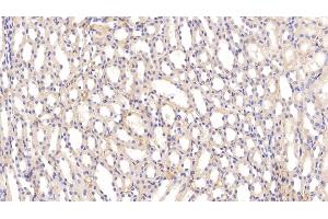 Immunohistochemistry (IHC) image for anti-Apolipoprotein E (APOE) (AA 19-168) antibody (ABIN7429139)