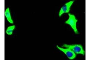 Immunofluorescence staining of HepG2 Cells with ABIN7127528 at 1:50, counter-stained with DAPI. (Rekombinanter Growth Hormone Receptor Antikörper)