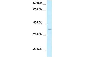 WB Suggested Anti-Six1 Antibody   Titration: 1. (SIX Homeobox 1 Antikörper  (N-Term))