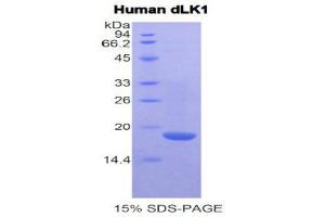 SDS-PAGE (SDS) image for delta-Like 1 Homolog (Drosophila) (DLK1) (AA 177-326) protein (His tag) (ABIN1079365)