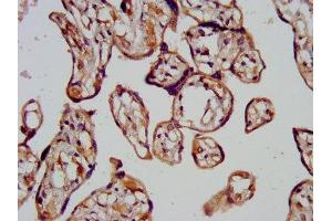 Immunohistochemistry (IHC) image for anti-Charged Multivesicular Body Protein 1A (CHMP1A) (AA 1-196) antibody (ABIN7147514)