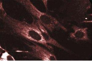 Immunofluorescent staining of WI-38 cells with anti-Akt antibody. (AKT1 Antikörper)