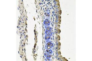 Immunohistochemistry of paraffin-embedded mouse lung using FLT1 antibody (ABIN4903685) at dilution of 1:100 (40x lens). (FLT1 Antikörper)