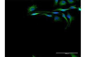 Immunofluorescence of purified MaxPab antibody to CAPN2 on HeLa cell.
