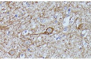 Immunohistochemistry of paraffin-embedded Mouse spinal cord using FKBP1B Polyclonal Antibody at dilution of 1:100 (40x lens).